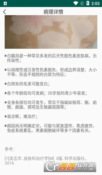 皮小宝(皮肤健康管理软件)截图